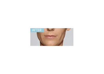 After Image: Defyne - front