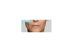 Before Image: Defyne
