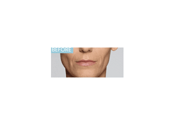 Before Image: Defyne - front