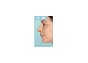 After Image: Defyne - left-side