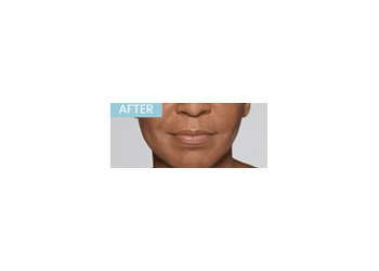After Image: Defyne - front