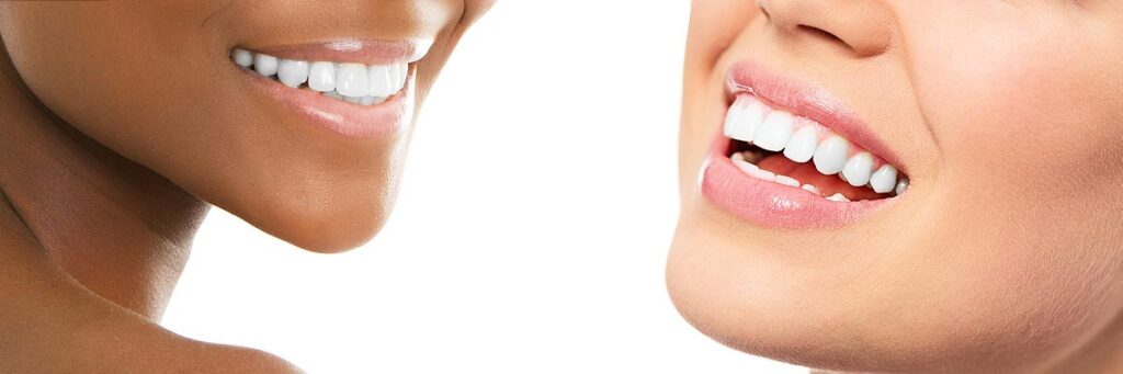 teeth whitening header