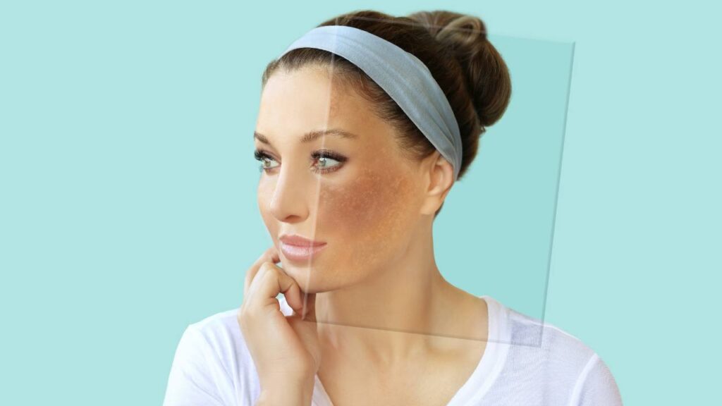Understanding Sun Damage Exploring the Layers of the Skin