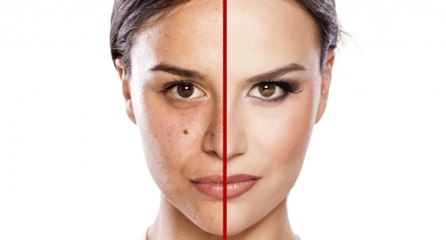 cosmetic