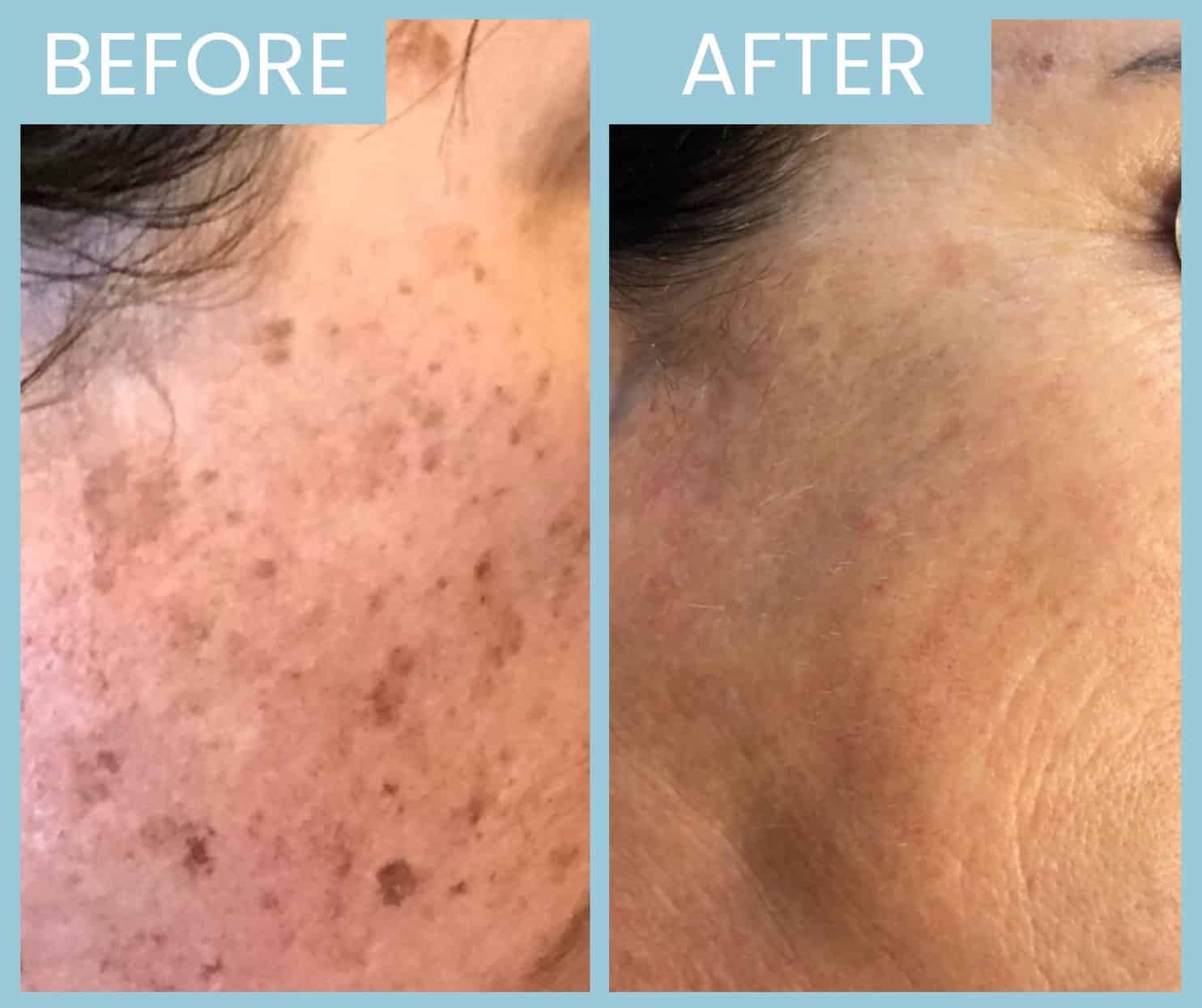 21 20220323131154 7656680 xlarge 21 20220323131154 7656680 xlarge