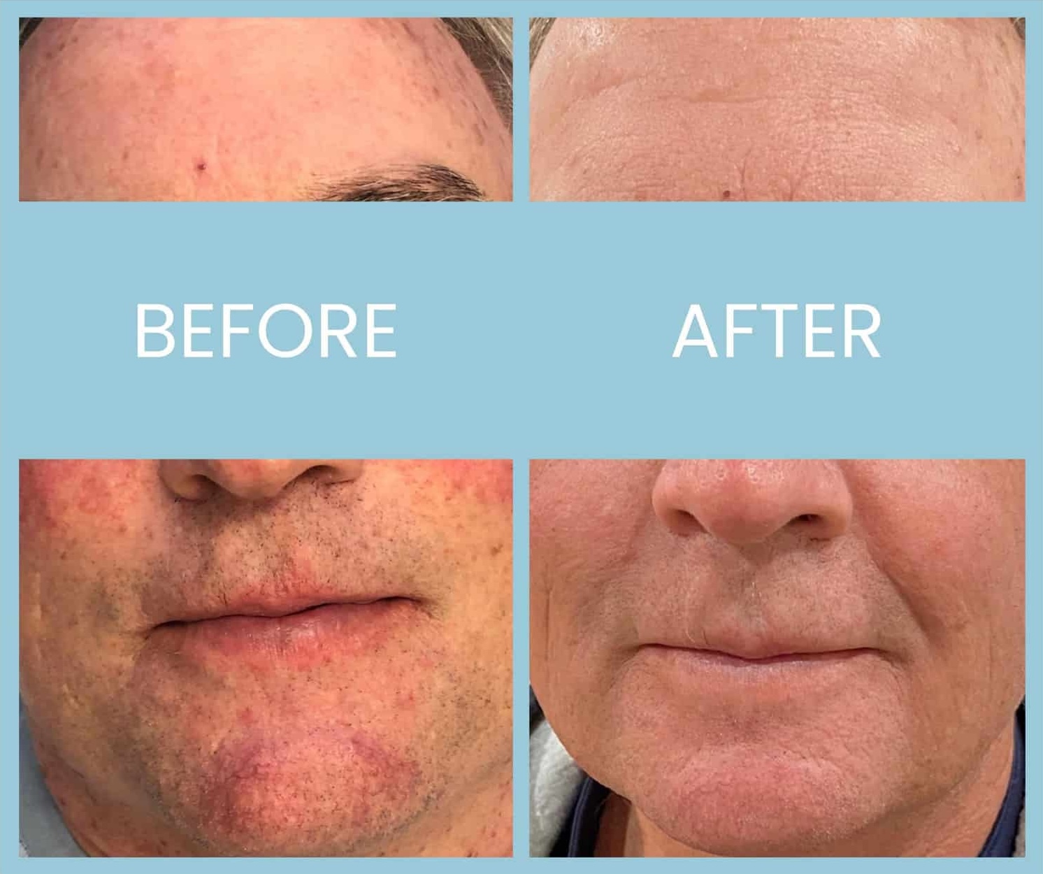 21 20220323131155 7656682 xlarge 21 20220323131155 7656682 xlarge