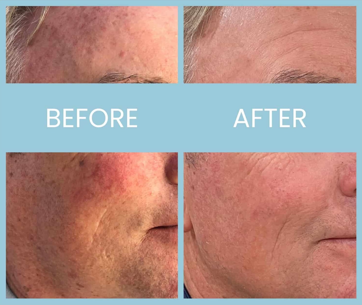 21 20220323131156 7656683 xlarge 21 20220323131156 7656683 xlarge