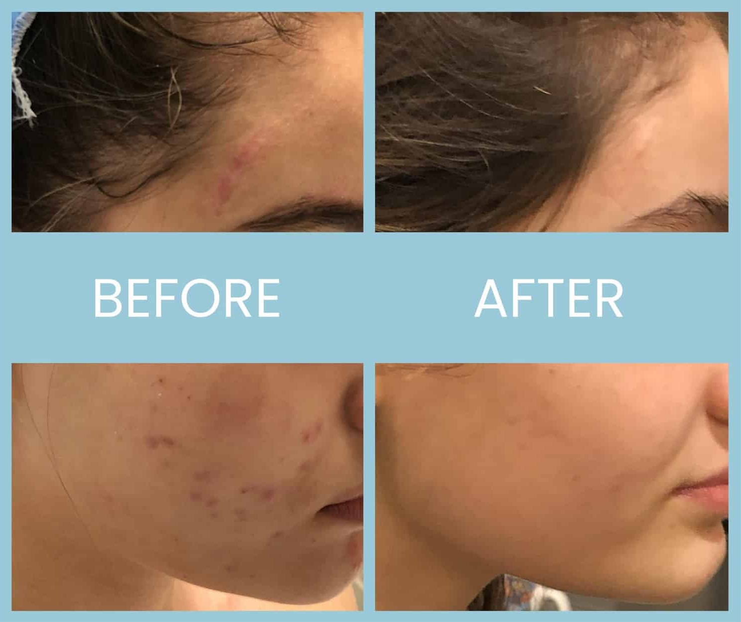 21 20220323131157 7656684 xlarge 21 20220323131157 7656684 xlarge