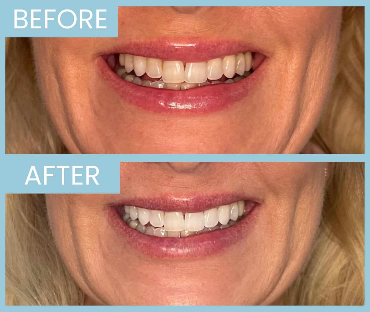 21 20220928113757 7967585 xlarge 21 20220928113757 7967585 xlarge