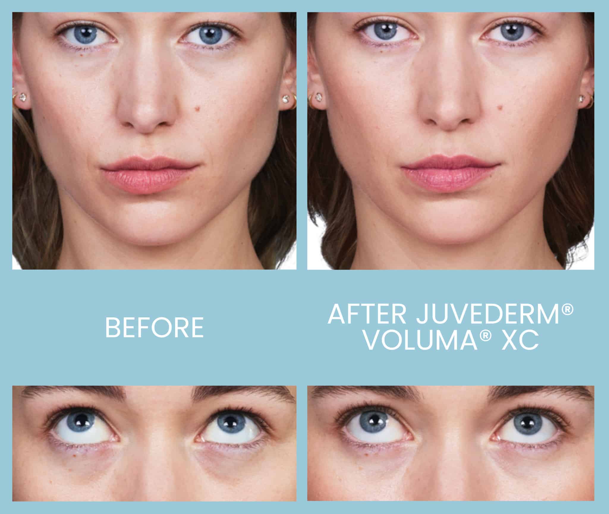 21 20230105162454 8176083 xlarge 21 20230105162454 8176083 xlarge