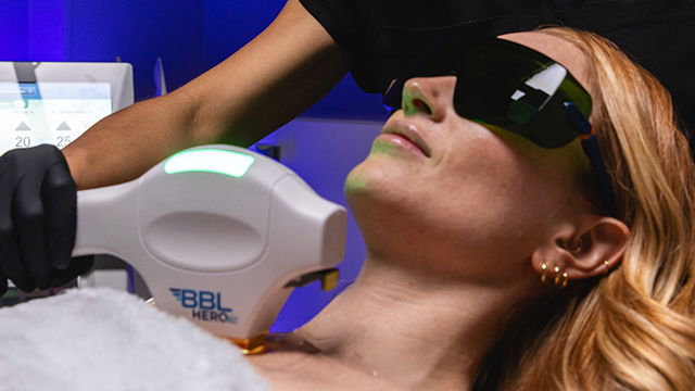 bbl heroic hyperpigmentation treatment balikian plastic surgery