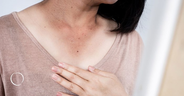 noninvasive procedures summer sun damage