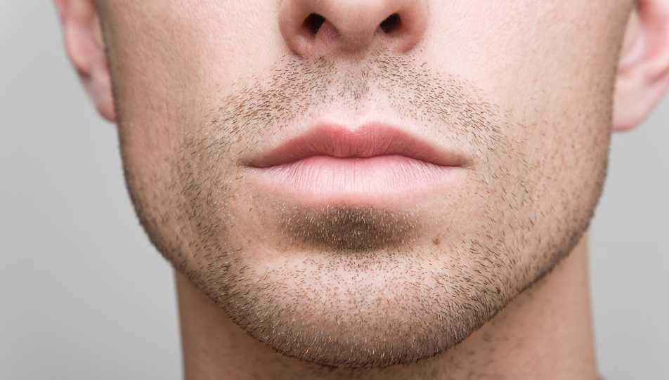 reduction machoire botox